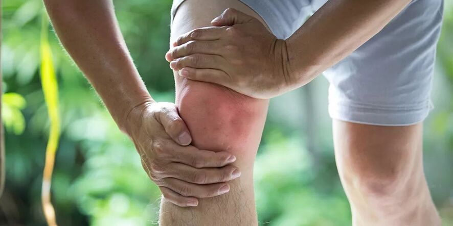 Severe pain during physical activity due to osteoarthritis of the knee joint